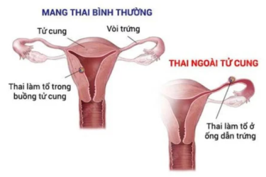 THANH TÂM